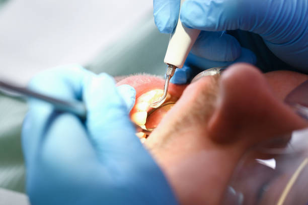 Best Dentist for Dental Trauma  in Reading, PA
